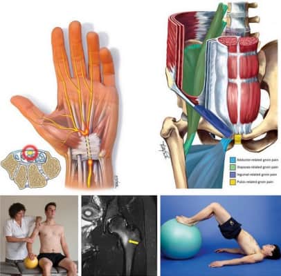 Brukner and Khans Clinical Sports Medicine Injuries, Volume 1 - Book