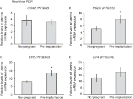 Prostaglandin-endoperoxide synthase 2 - 