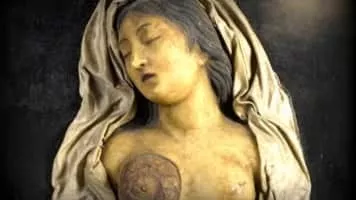 Carl Tanzler - German radiographer