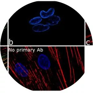 Actinin alpha 2 - Protein