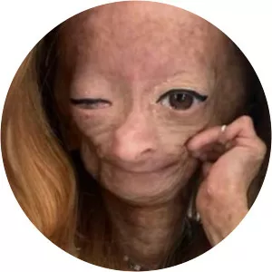 Adalia Rose Williams - YouTuber
