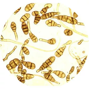 Alternaria alternata