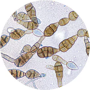 Alternaria