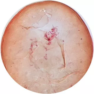 Aonidiella orientalis