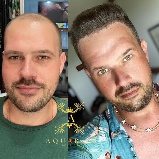 Aquarius Clinic - Hair transplantation clinic in Istanbul