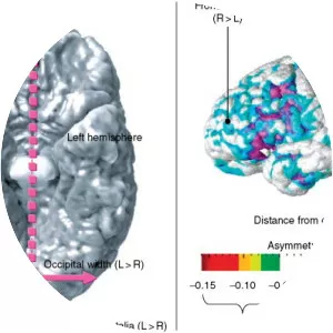 Brain asymmetry - 