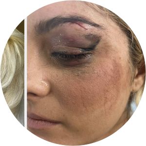 Bukurije Rexha photograph