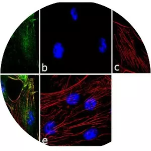 Calponin 1 - Protein
