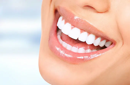 Carillas Dentales Aravaca