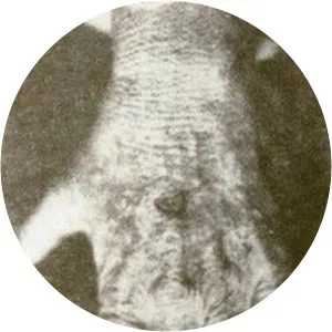 Cash-Landrum incident - 