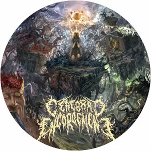 Cerebral Engorgement