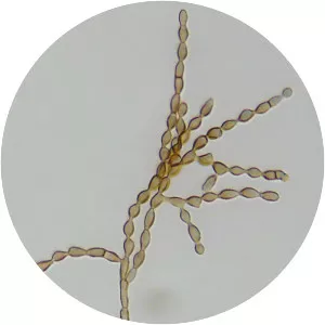Cladosporium cladosporioides