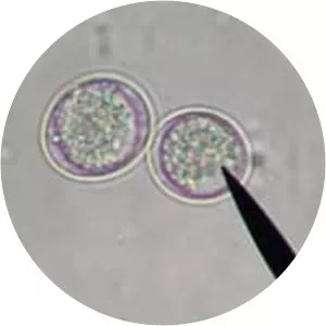 Coccidia