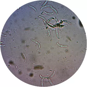 Colletotrichum capsici