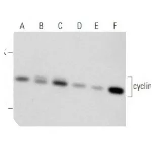 Cyclin D1