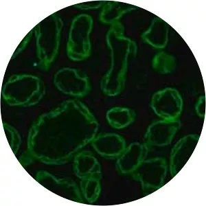 Cytokeratin (Sitokeratin)