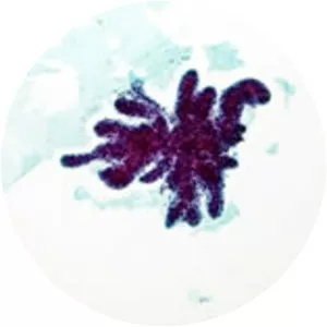 Cytopathology photograph