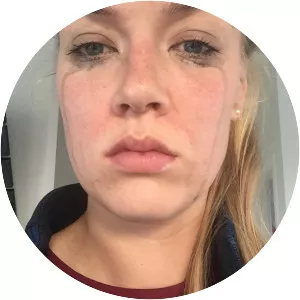 Dagný Brynjarsdóttir