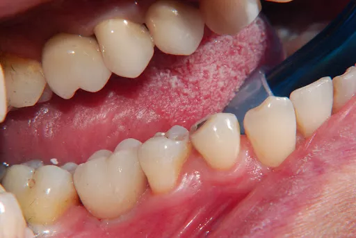 DENTAL FACTORY Riparazioni Protesi