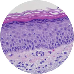 Dermatopathology