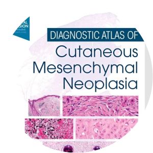 Diagnostic Atlas of Cutaneous Mesenchymal Neoplasia - Book by Alexander J Lazar, Bostjan Luzar, and Eduardo Calonje