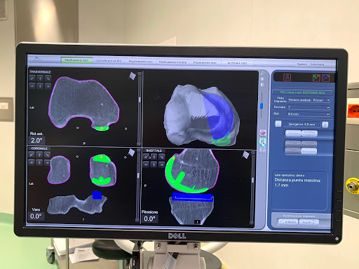 Dott. Antonello Della Rocca - Orthopedic surgeon in Tortona, Italy