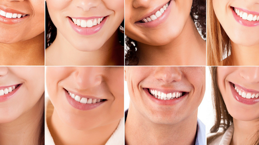 Dott.ssa Gisella Principe Igienista Dentale - Recco - Dental hygienist in Recco, Italy