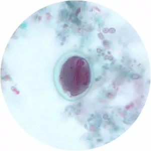 Giardia