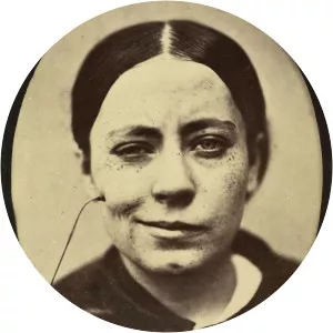 Guillaume Duchenne de Boulogne