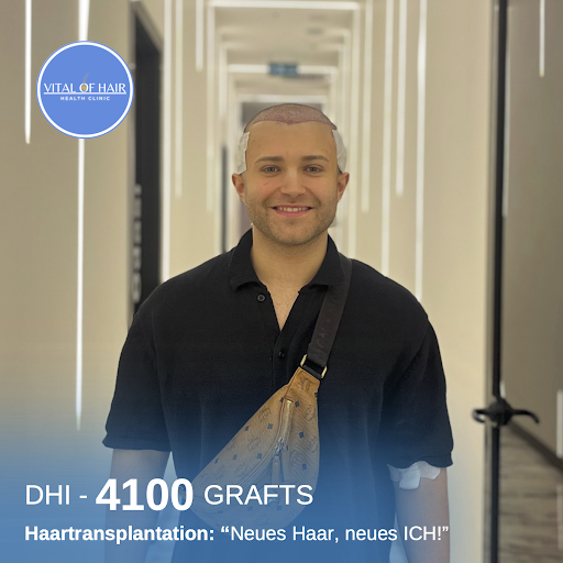 Haartransplantation by Vital of Hair