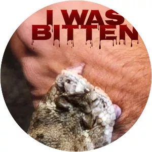 I Was Bitten
