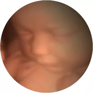 In the Womb: Multiples - TV program