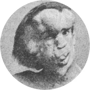Joseph Merrick