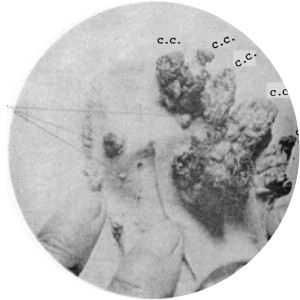 Katsusaburo Yamagiwa