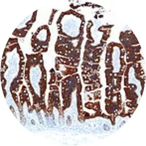 Keratin 20 - Protein