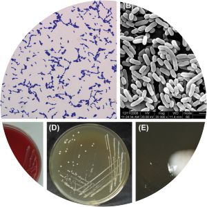 Lactobacillus paracasei