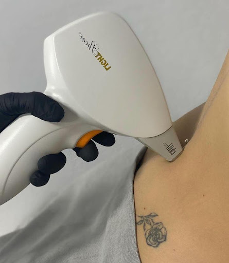 LAZERKA KALUSH - Laser hair removal service in Kalush, Ukraine