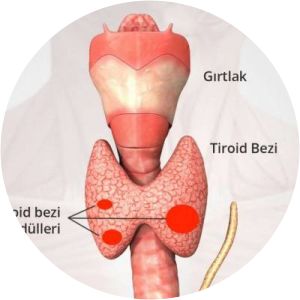 Llywelyn Ddiriaid photograph