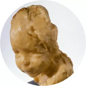 Medardo Rosso