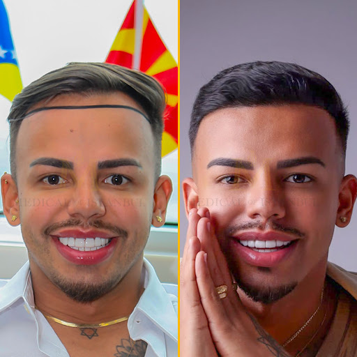 Medical of Istanbul Hospital Hair Transplantation - Hair transplantation clinic in Istanbul