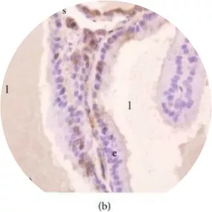 Melatonin receptor 1B - Protein
