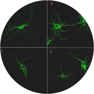Microtubule-associated protein 2 - 
