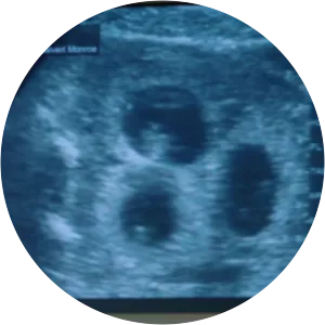 Monroe and Rosalee's Triplets - 