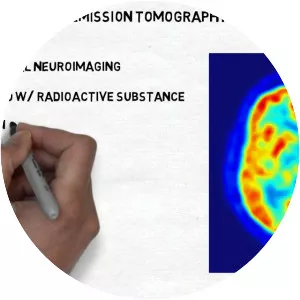 Neuroimaging