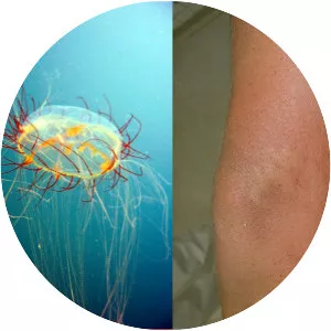 Olindias sambaquiensis - 