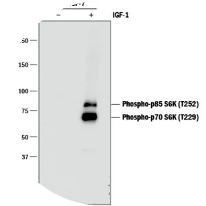 P70-S6 Kinase 1 - Protein