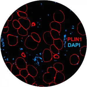 Perilipin-1 - Protein