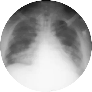 Phosgene - Chemical compound