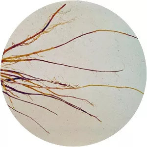 Phytophthora fragariae