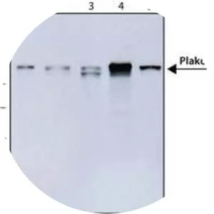Plakoglobin - Protein